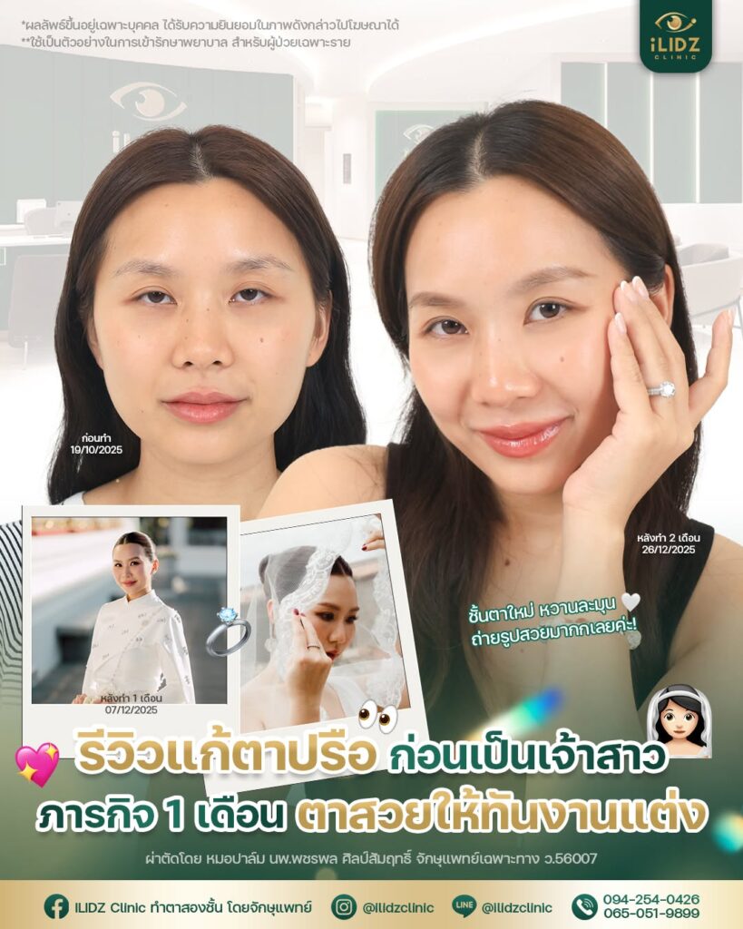 ตาสองชั้น ปรับกล้ามเนื้อตาอ่อนแรง