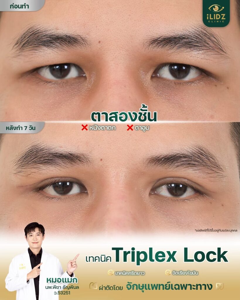 ทำตาสองชั้น