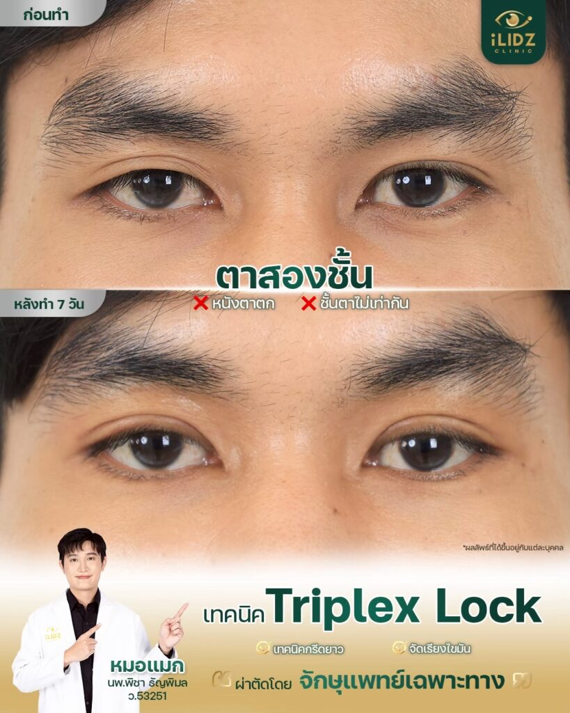 ทำตาสองชั้น