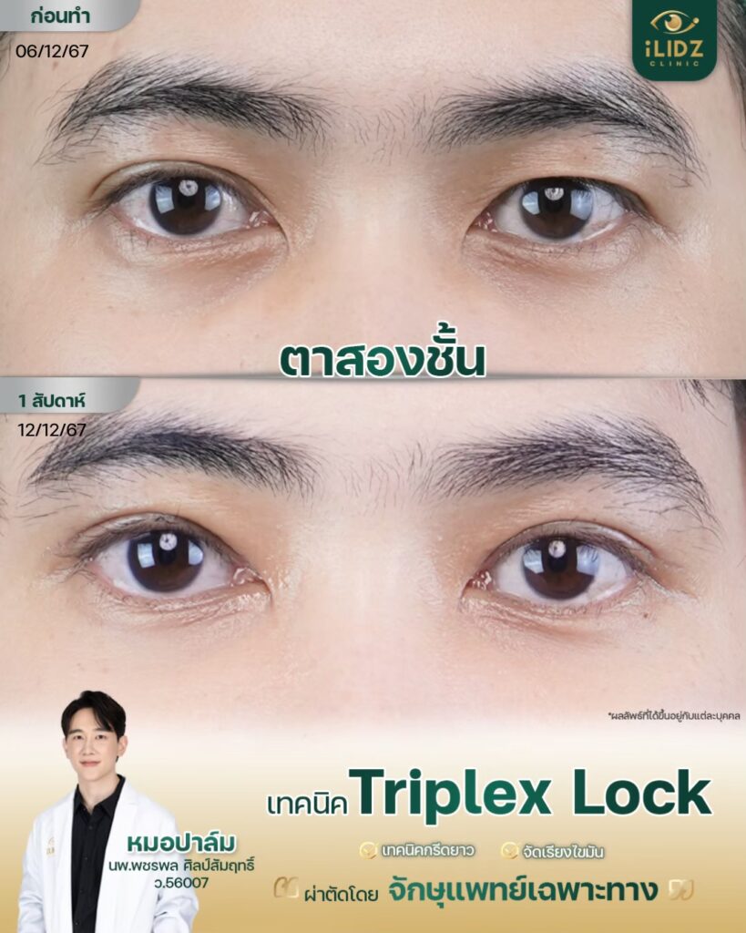 ทำตาสองชั้น