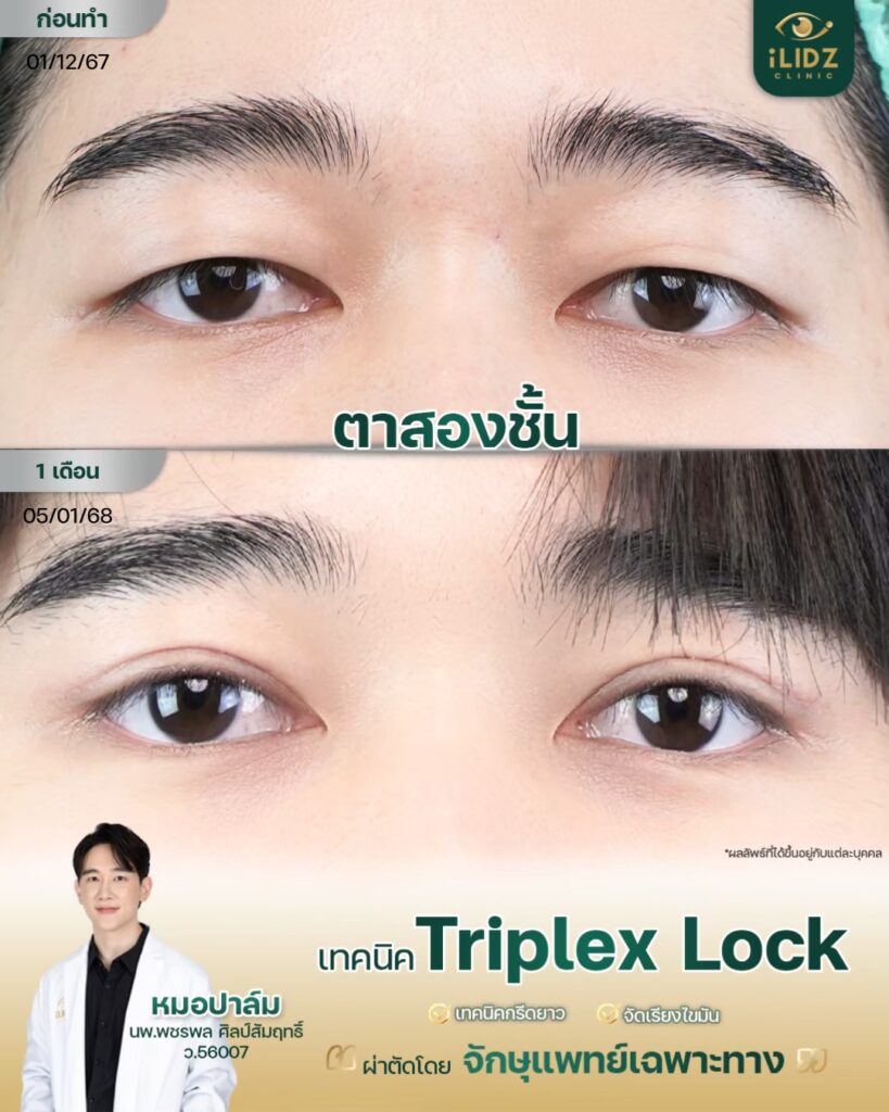 ทำตาสองชั้น