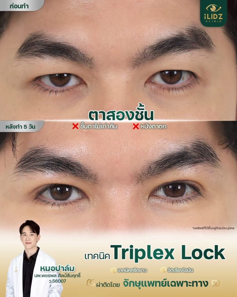 ทำตาสองชั้น