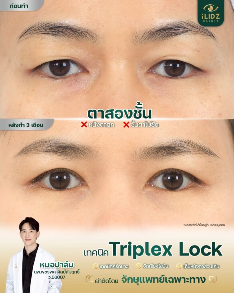 ทำตาสองชั้น