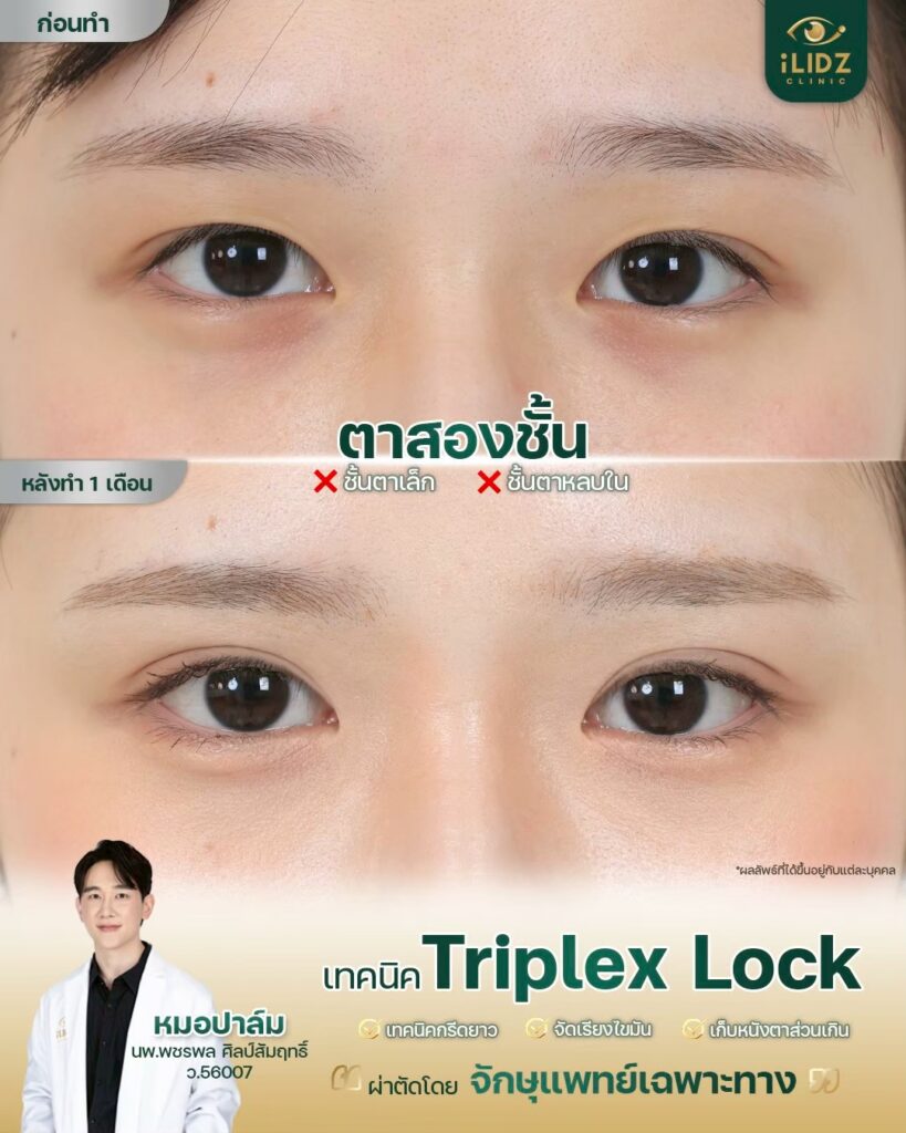 ทำตาสองชั้น