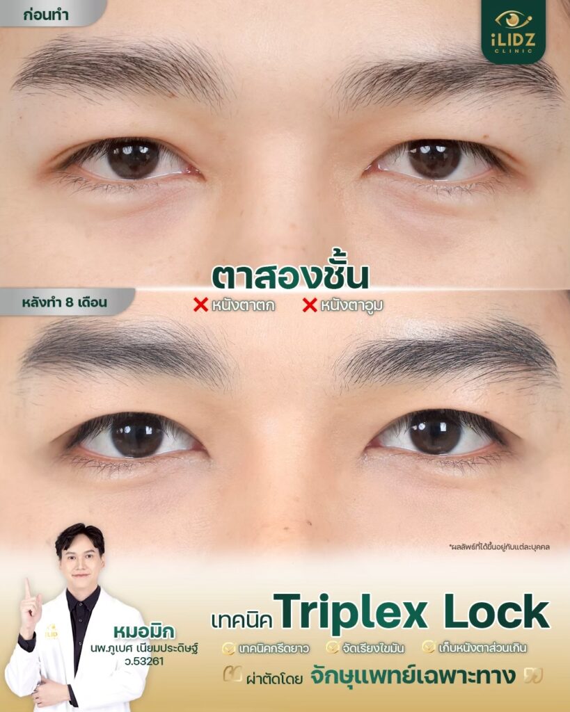 ทำตาสองชั้น