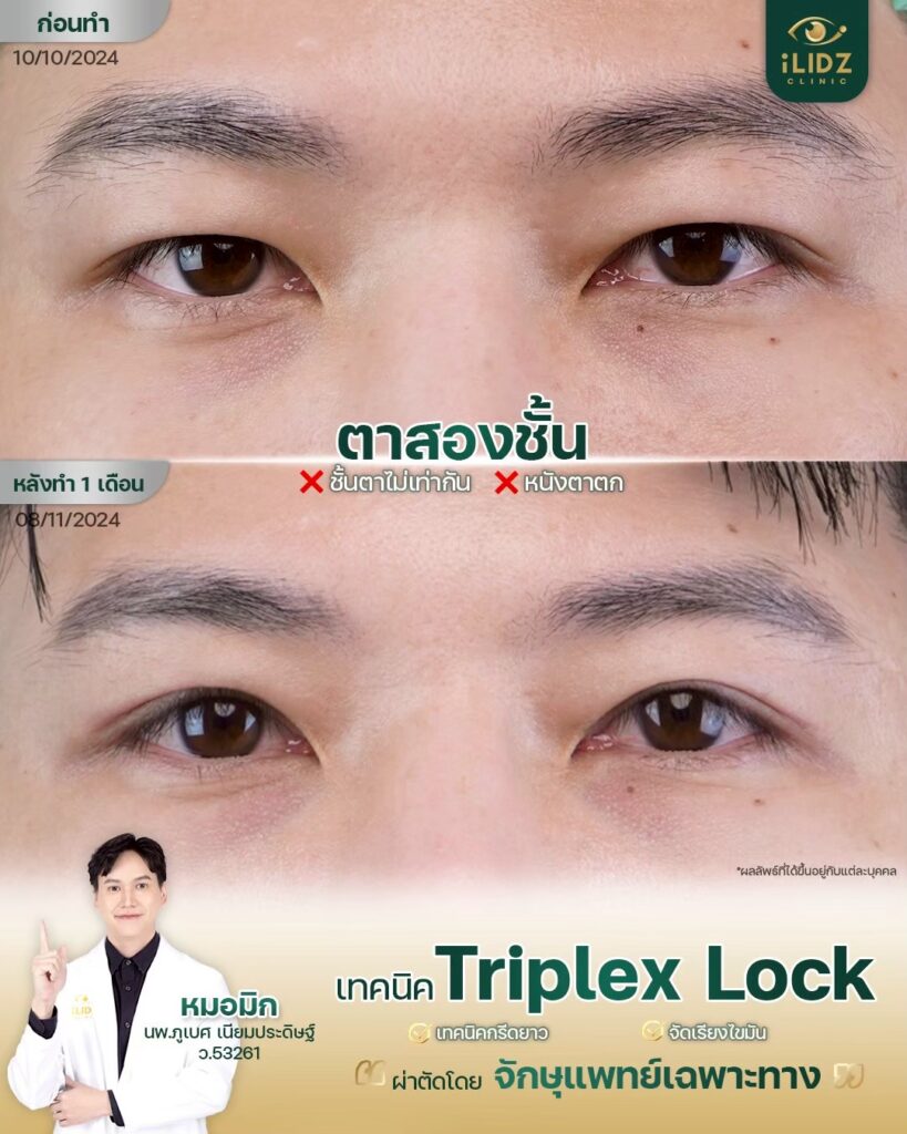 ทำตาสองชั้น