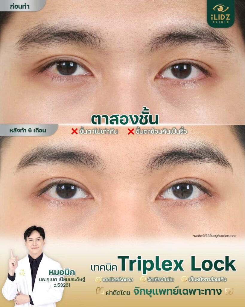 ทำตาสองชั้น