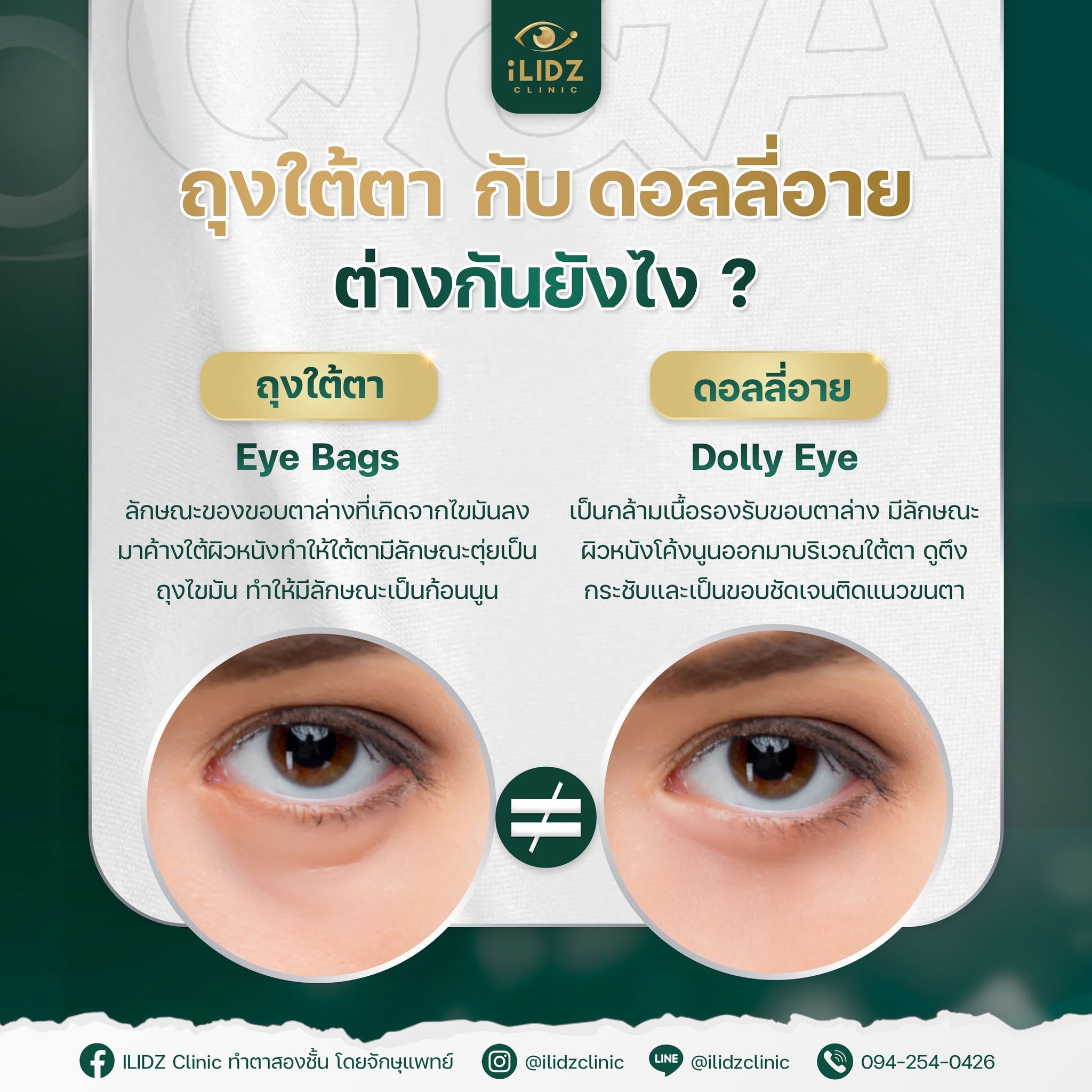 ถุงใต้ตา