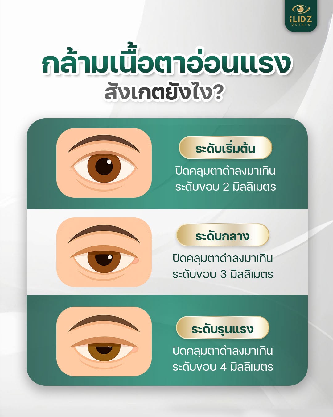 ระดับกลามเนื้อตาอ่อนแรง