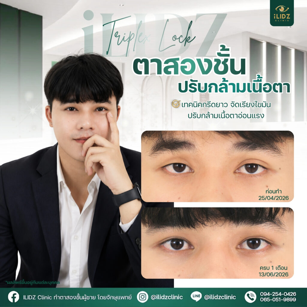 ตาสองชั้นผู้ชาย